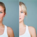 علاج الجلد بالخلايا الجذعية