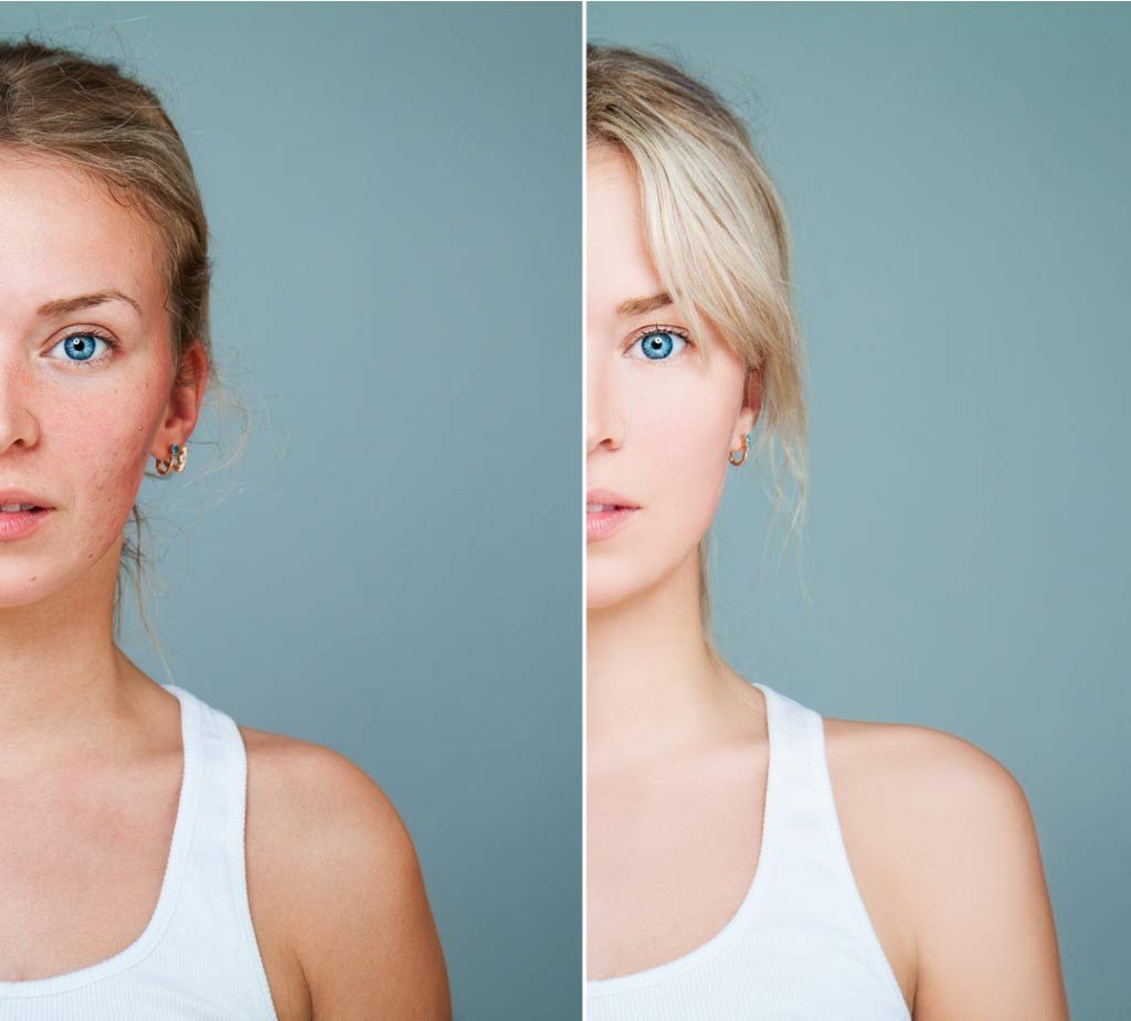 علاج الجلد بالخلايا الجذعية